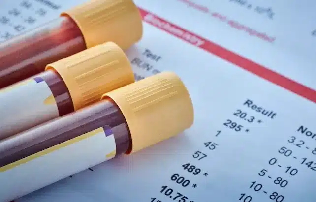 Cholesterol: The Good, The Bad and the Not So Ugly!