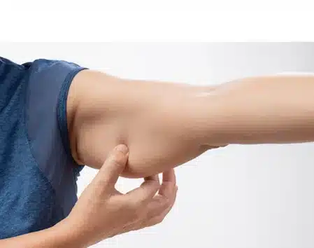 Person pinching arm skin, representing muscle and body composition changes