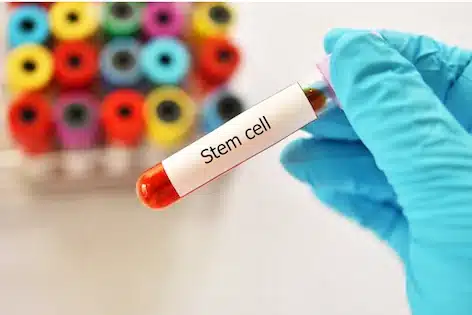 Gloved hand holding a laboratory tube labeled Stem Cell
